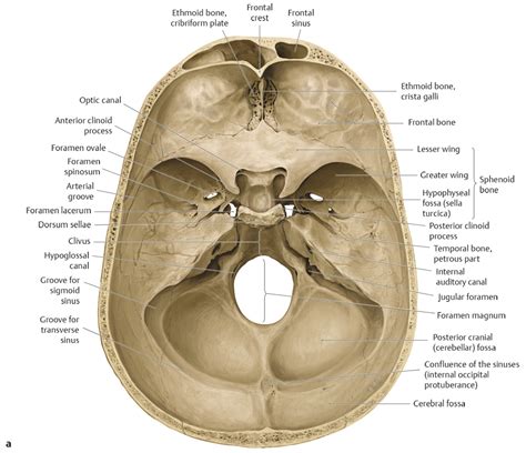 16 Skull Base And Cranial Nerves Radiology Key