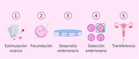 Cuáles son las principales ventajas de la fecundación in vitro