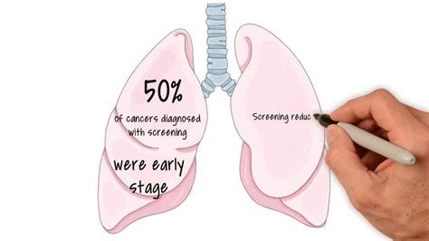 Lung Cancer Screening By First To Draw Limited Youtube