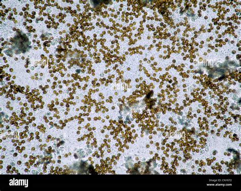 Microscopic Photo Of Symbiotic Algae Zooxanthellae Of The