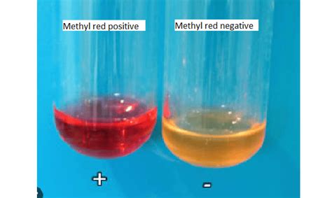 Methyl Red Test Procedure Principle And Result Laboratoryintern