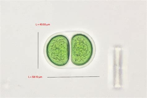 Croococcus The Microscopic Life Of Shetland Lochs