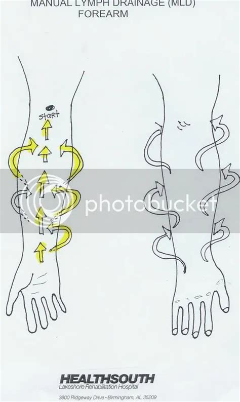 Manual Lymph Drainage Mld Arm Illustrated Patterns Lymphedemaville