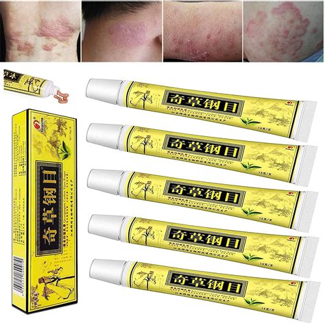 Buy Nobrand1 5pcs Lot Chinese Herbal Eczema Psoriasis Creameczema