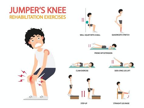 Jumper S Knee Rehabilitation Exercises Infographic Illustration Vector Art At Vecteezy