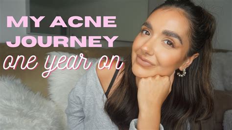 My Journey From Acne To Clear Skin Epiduo Skincare Acne Scars Youtube
