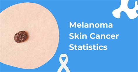 Melanoma Skin Cancer Statistics