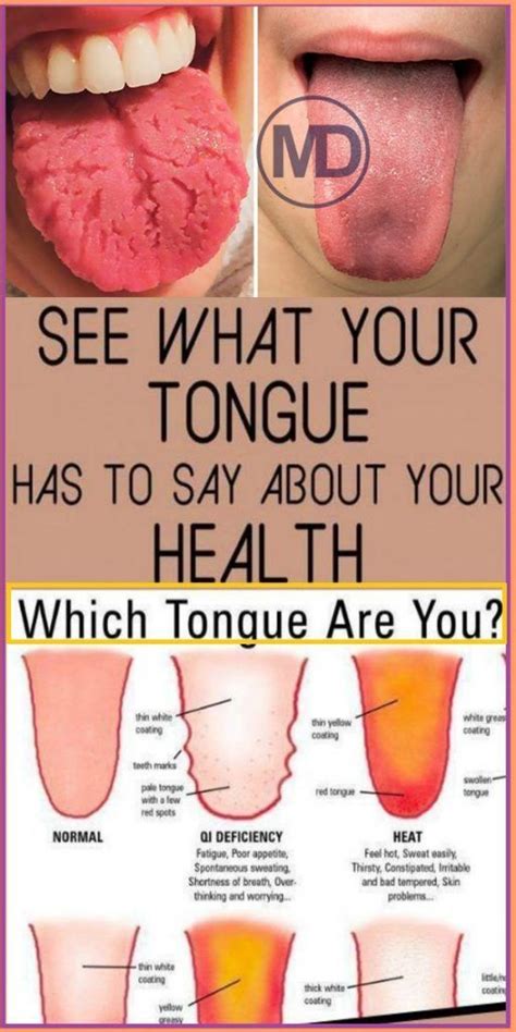 What Your Tongue Can Tell You About Your Health Tongue Health Health