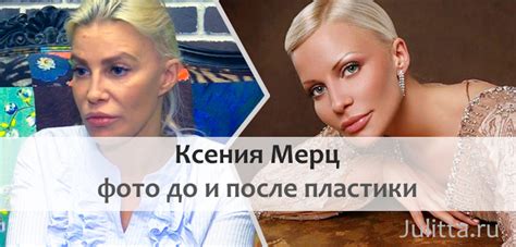 Супруга владельца «спартака» леонида федуна зарема салихова дала большое интервью автор: Ксения МЕРЦ: фото ДО пластики и ПОСЛЕ операций