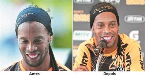 Ronaldinho gaucho llegando al hotel palmaroga, este martes, en asunción (paraguay). Bonito sorriso, Ronaldinho - Encontro Indica