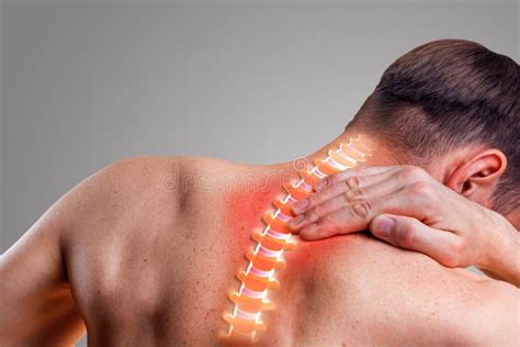 Pain In The Cervical Spine Symptom Of Cervical Chondrosis Stock Photo