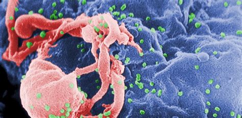 2nd HIV Patient Reportedly Clear Of Virus After Stem Cell Therapy AVN