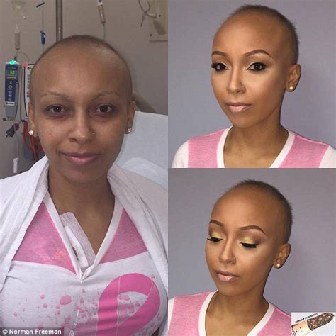 Make Up Artist And Alopecia Sufferer Gives Makeovers To Cancer Patients Daily Mail Online
