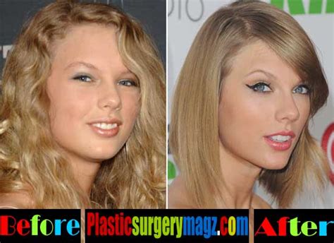 Taylor Swift Nose Job Before And After Plastic Surgery Magazine
