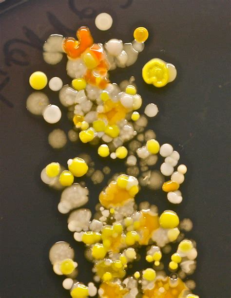 Colorful Cluster Of Colonies Seen On A Print From A Finger Grown On Tsa