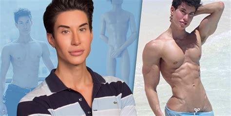 Real Life Ken Doll Update I M Up To 145 Cosmetic Procedures And Plastic Surgeries And Have