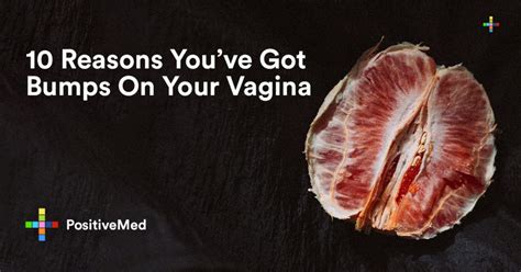 Reasons You Have Got Bumps On Your Vagina