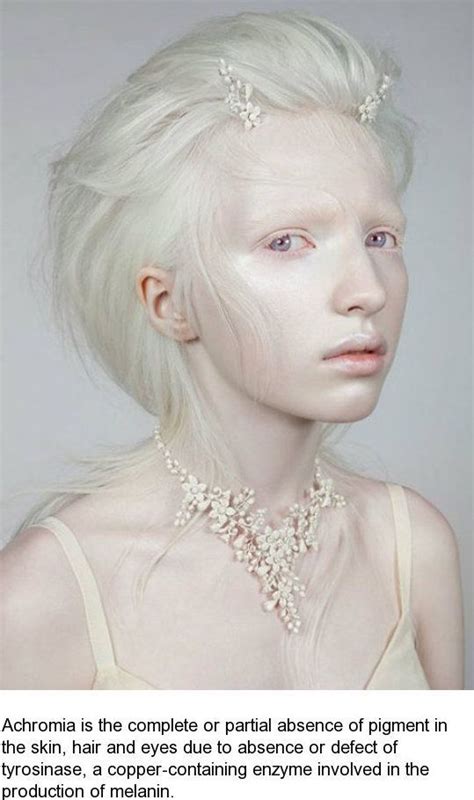 Pin By Vaykareth Aurori On Art Inspiration With Images Albino Girl