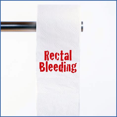 Rectal Bleeding As A Symptom Gastroenterology Of Greater Orlando
