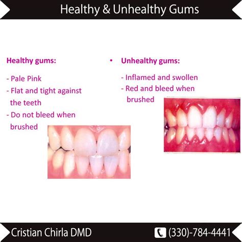 Maybe you would like to learn more about one of these? Oral Surgery Akron | Cosmetic Dentistry Ohio | Best ...