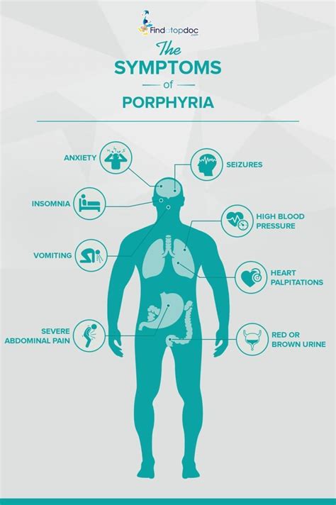 Porphyria Attack Symptoms