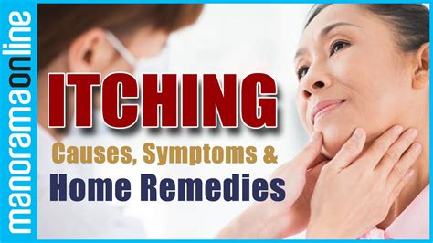 Itching Causes Home Remedies Health Tips Manorama Online Youtube