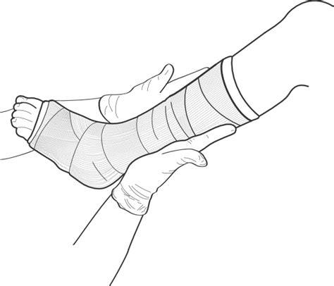 Arm Cast Coloring Page Coloring Pages