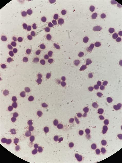 Direct Gram Stain From A Positive Blood Culture Flagged On Day 4