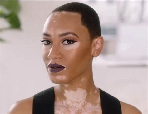Covergirl Features Their First Black Model With Vitiligo In New