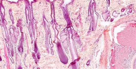 Lip Sebaceous Glands Cat Hande Utcvmhs015 Histology Fal Flickr