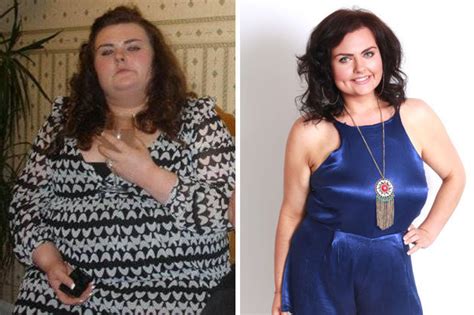Too Fat For Sex Woman Sheds STONE After Belly Gets In The Way Of Love Making Daily Star