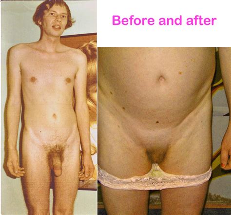 Transgender Before And After Nude Telegraph