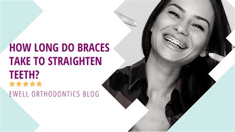 How To Straighten Teeth Without Braces Uk Adult Braces Why Are More Grown Ups Getting Their