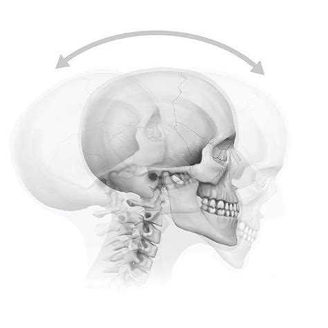 Sagittal Plane Head