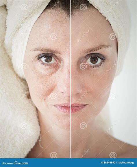 Beauty Concept Skin Care Anti Aging Procedures Rejuvenation