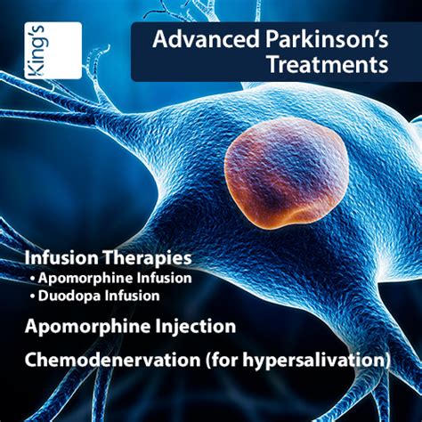 Advanced Parkinsons Treatment In Dubai Kings College Hospital Dubai