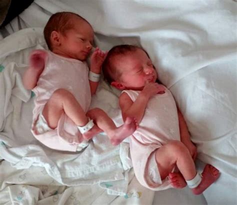 Twins Born At 36 2 Weeks My Twin Birth Story Twinfo