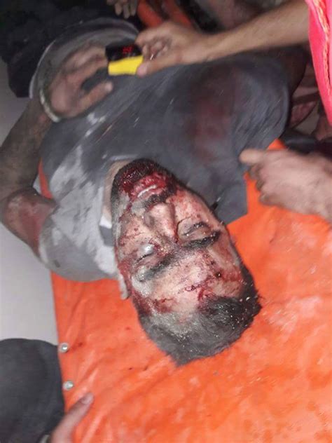 ميسي يهنئ زوجته بعيد ميلادها الـ33 على طريقته الخاصة (صور). بالصور الناشط السوري هادي العبدالله ينجو باعجوبة و «جنوبية» تتمنى له الشفاء العاجل | جنوبية