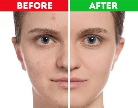 8 Bad Skin Habits That Age You Faster Premature Aging Skin Skin