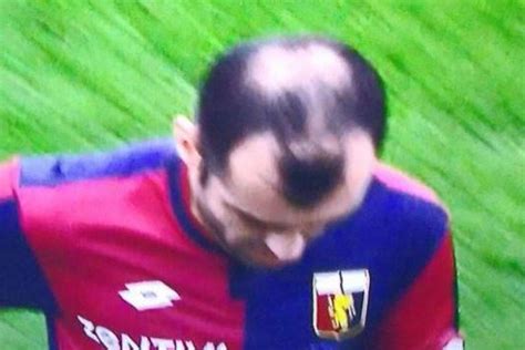 Goran Pandevs Hair Brutally Trolled As Genoa Mans Bald Patch
