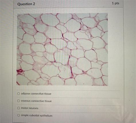 Solved Question 1 O Hyaline Cartilage Connective Tissue Chegg