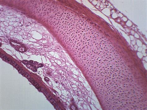 Trachea Mammal Prepared Microscope Slide X Mm Microscope