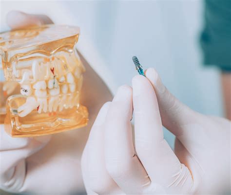 Προσθετική δοντιών Οδοντιατρική Κλινική Άλιμος Καλαμάκι Οδοντιατρείo