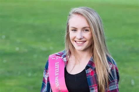 Girl Bullied For Being Spotty And Skinny Has Last Laugh After Being Crowned A Beauty