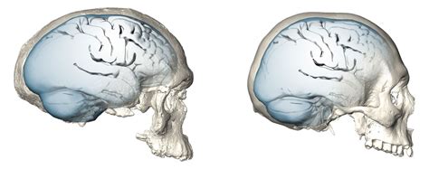 Scientists Reveal The Evolution Of Modern Human Brain Shape