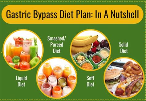 Gastric Bypass Diet Plan In A Nutshell Hope My Worlds