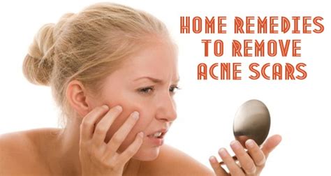 Top 10 Home Remedies To Remove Acne Scars