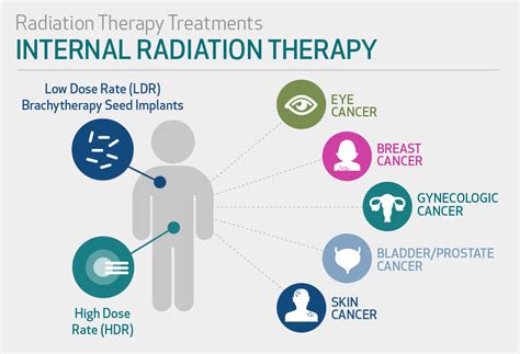 Cytotoxic antibiotics, also known as anthracyclines, disrupt rna synthesis and dna reproduction in the cells. Radiation Therapy | Houston Methodist