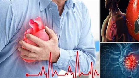 9 Gejala Serangan Jantung Yang Mesti Diwaspadai Terasa Nyeri Di Dada