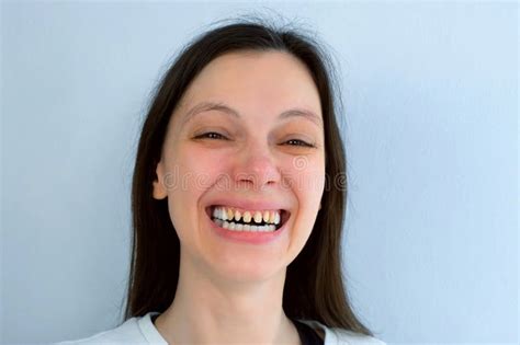 443 Scary Face Bad Teeth Stock Photos Free And Royalty Free Stock